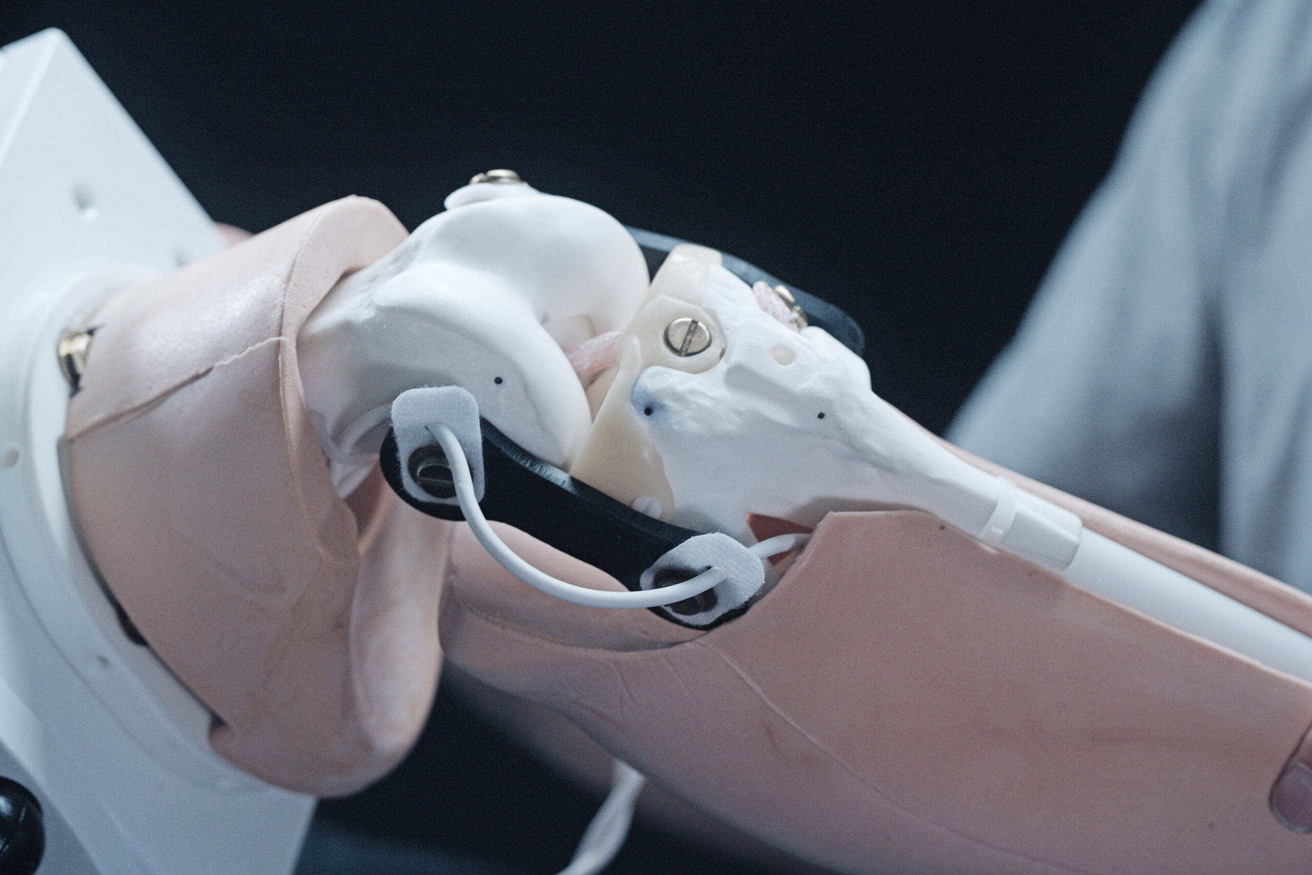 Chirurgisches SLS Bauteil. Additiv gefertigt